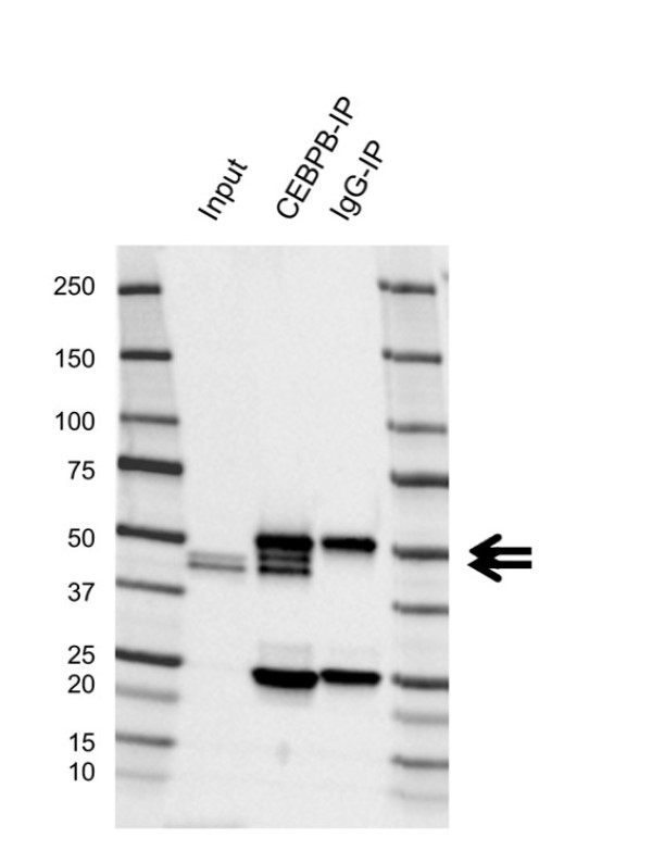 Anti Human Cebpb Antibody, clone L01/5C4 (PrecisionAb Monoclonal Antibody) gallery image 2
