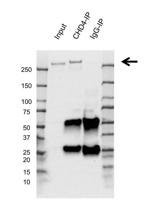 Anti CHD4 Antibody, clone AB01/2B7 (PrecisionAb Monoclonal Antibody) gallery image 4