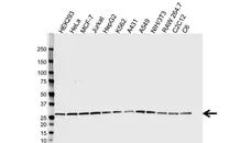Anti CHP2 Antibody, clone CPTC19 (PrecisionAb Monoclonal Antibody) gallery image 1