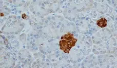 Anti Human Chromogranin A Antibody, clone LK2H10 gallery image 1
