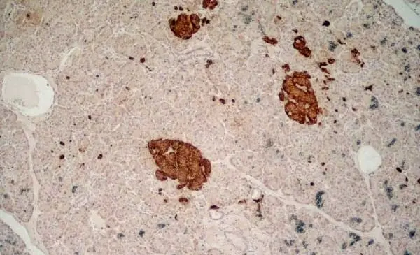 Anti Human Chromogranin A Antibody, clone LK2H10 gallery image 2