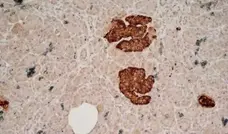 Anti Human Chromogranin A Antibody, clone LK2H10 gallery image 3
