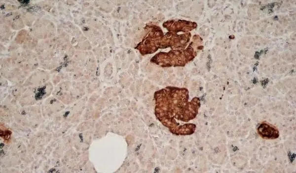 Anti Human Chromogranin A Antibody, clone LK2H10 gallery image 3