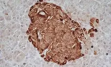 Anti Human Chromogranin A Antibody, clone LK2H10 gallery image 4