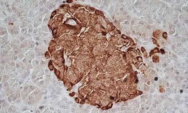 Anti Human Chromogranin A Antibody, clone LK2H10 gallery image 4