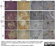 Anti Human Chymotrypsin Antibody, clone CHYMO10-104.5 (4E1) gallery image 1