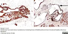 Anti Human Chymotrypsin Antibody, clone CHYMO10-104.5 (4E1) gallery image 2