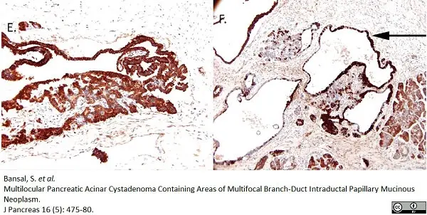 Anti Human Chymotrypsin Antibody, clone CHYMO10-104.5 (4E1) gallery image 2