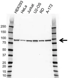 Anti CIP2A Antibody, clone OTI1C11 (PrecisionAb Monoclonal Antibody) gallery image 1