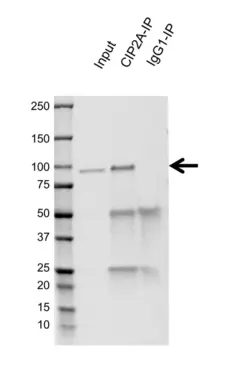 Anti CIP2A Antibody, clone OTI1C11 (PrecisionAb Monoclonal Antibody) gallery image 2
