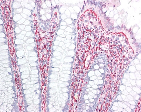 Anti Human Collagen II Antibody, clone COLL-II gallery image 1