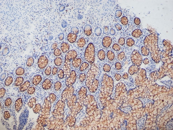 Anti Human Collagen VII Antibody, clone LH7.2 gallery image 1