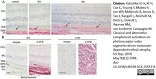 Anti Human Complement Factor B (Ba Fragment) Antibody, clone 014III-33.2.4.3 gallery image 1