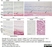 Anti Human Complement Factor B (Ba Fragment) Antibody, clone 014III-33.2.4.3 thumbnail image 1