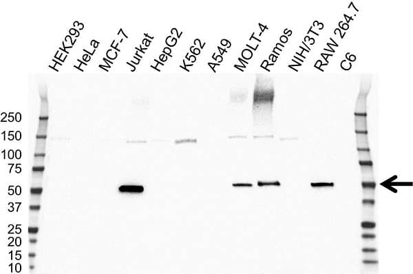 Anti Coro1A Antibody, clone OTI1A5 (PrecisionAb Monoclonal Antibody) gallery image 1