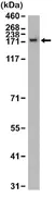 Anti CPS1 Antibody, clone RM395 thumbnail image 1