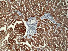 Anti CPS1 Antibody, clone RM395 gallery image 2