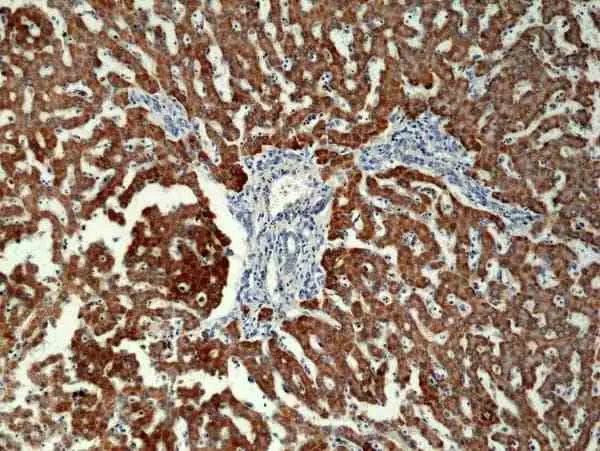 Anti CPS1 Antibody, clone RM395 gallery image 2