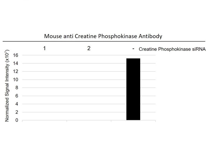 Anti Creatine Phosphokinase Antibody, clone E05/10G2 (PrecisionAb Monoclonal Antibody) gallery image 3