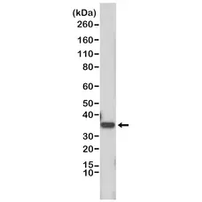 Anti Cyclin D1 Antibody, clone RM241 gallery image 1