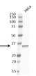 Anti Cyclin D1 Antibody, clone RM241 thumbnail image 2