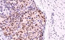 Anti Cyclin D1 Antibody, clone RM241 gallery image 3