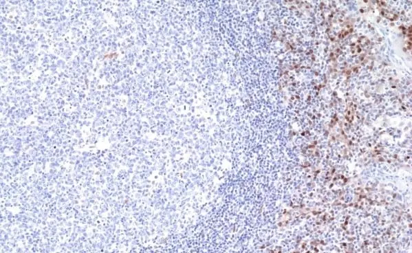 Anti Cyclin D1 Antibody, clone RM241 gallery image 4