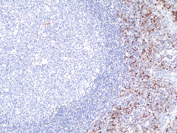 Anti Cyclin D1 Antibody, clone RM241 gallery image 4