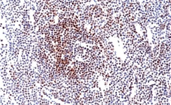 Anti Cyclin D1 Antibody, clone RM241 gallery image 5