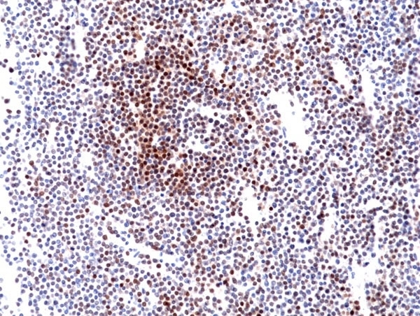 Anti Cyclin D1 Antibody, clone RM241 gallery image 5