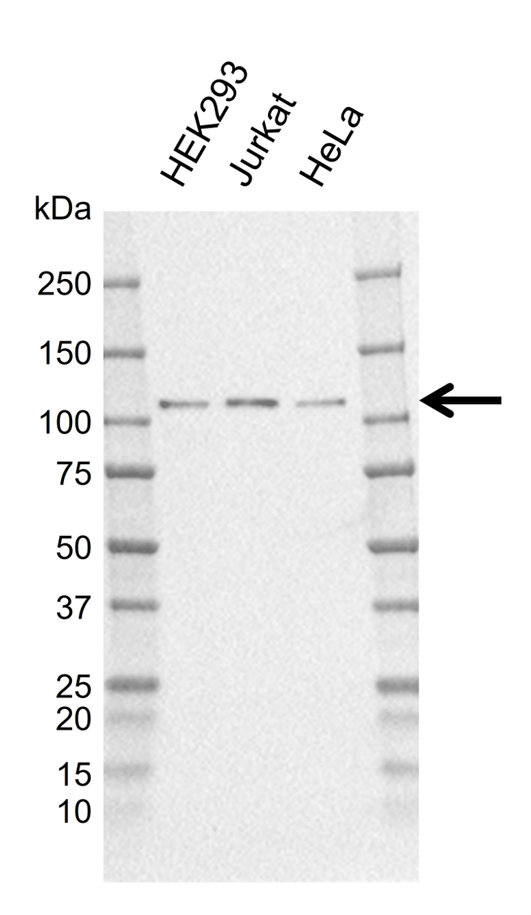 Anti Human Cyld Antibody, clone CD02/3E12-1 gallery image 1