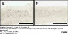 Anti Human Cytochrome P450 Aromatase Antibody, clone H4 gallery image 13