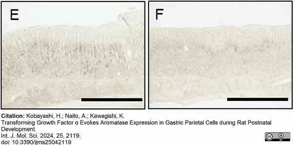 Anti Human Cytochrome P450 Aromatase Antibody, clone H4 gallery image 13