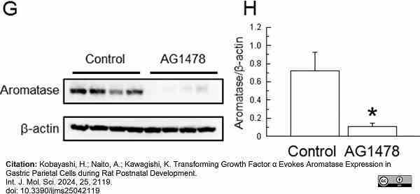 Anti Human Cytochrome P450 Aromatase Antibody, clone H4 gallery image 14