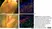 Anti Human Cytochrome P450 Aromatase Antibody, clone H4 thumbnail image 17