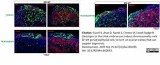 Anti Human Cytochrome P450 Aromatase Antibody, clone H4 gallery image 18