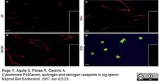 Anti Human Cytochrome P450 Aromatase Antibody, clone H4 gallery image 4