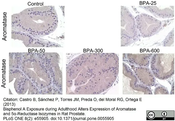 Anti Human Cytochrome P450 Aromatase Antibody, clone H4 gallery image 6