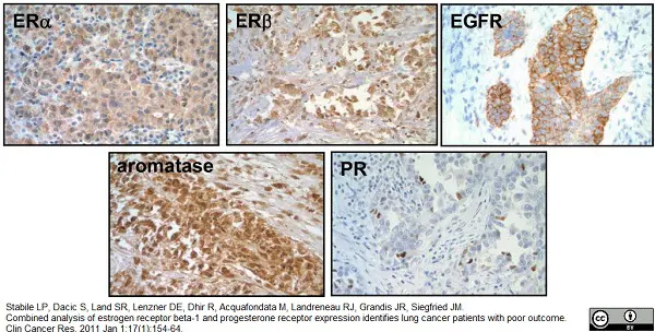 Anti Human Cytochrome P450 Aromatase Antibody, clone H4 gallery image 7