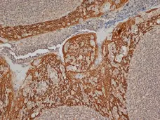 Anti Human Cytokeratin 14 Antibody, clone LL002 gallery image 1