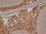 Anti Human Cytokeratin 14 Antibody, clone LL002 thumbnail image 1