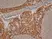 Anti Human Cytokeratin 14 Antibody, clone LL002 thumbnail image 1
