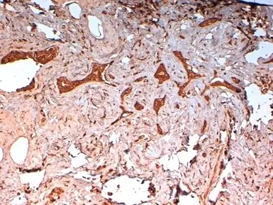 Anti Human Cytokeratin 14 Antibody, clone LL002 gallery image 2
