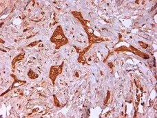 Anti Human Cytokeratin 14 Antibody, clone LL002 gallery image 3