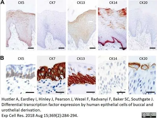 Anti Human Cytokeratin 14 Antibody, clone LL002 gallery image 5