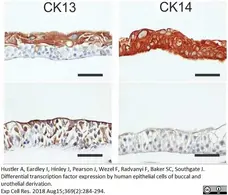 Anti Human Cytokeratin 14 Antibody, clone LL002 gallery image 6