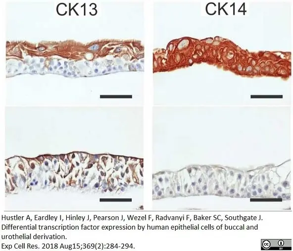 Anti Human Cytokeratin 14 Antibody, clone LL002 gallery image 6