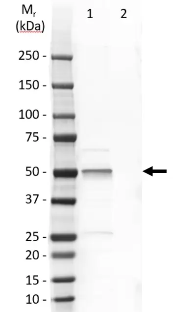 Anti Human Cytokeratin 14 Antibody, clone LL002 gallery image 7