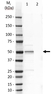 Anti Human Cytokeratin 14 Antibody, clone LL002 thumbnail image 7
