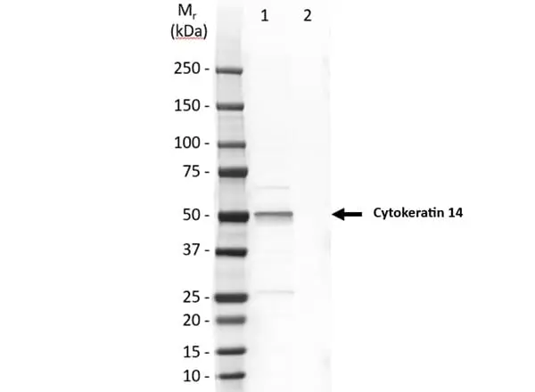 Anti Human Cytokeratin 14 Antibody, clone LL002 gallery image 7